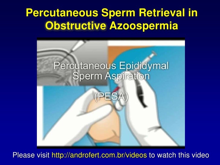 Sperm retrevial after prostatectomy Cat pussy wicked